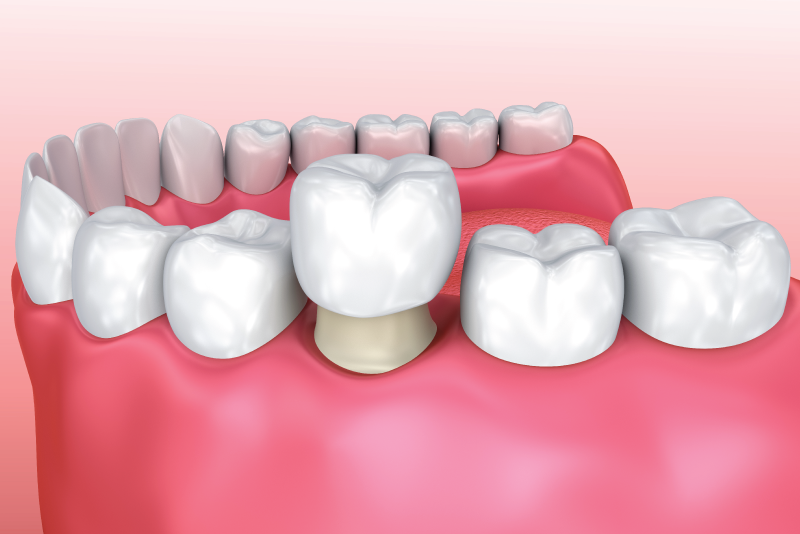 restorative dentistry Our services Red Deer Dental Clinic Dentists